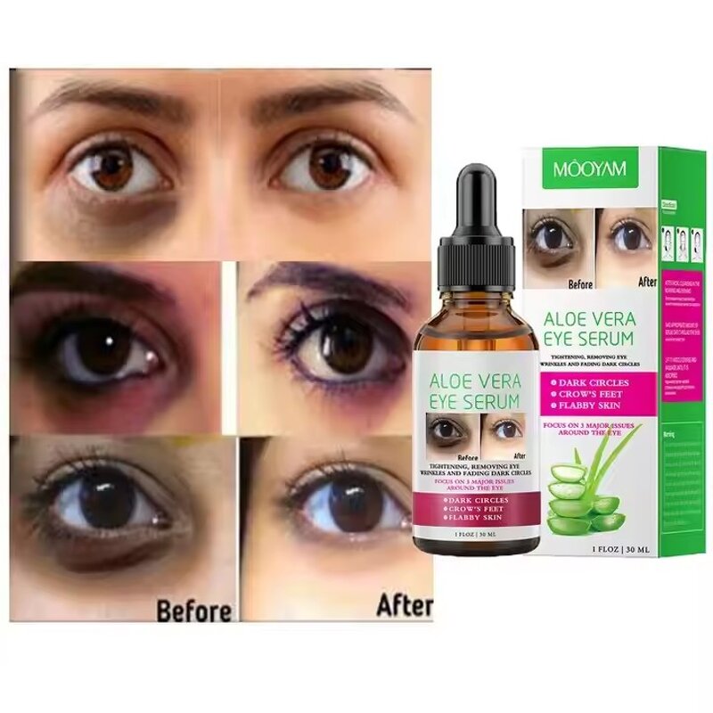 Eye Care Serum Manufacturer - Aloe Extract Anti Dark Circles Anti-Wrinkle Remove Eye Bag Puffiness