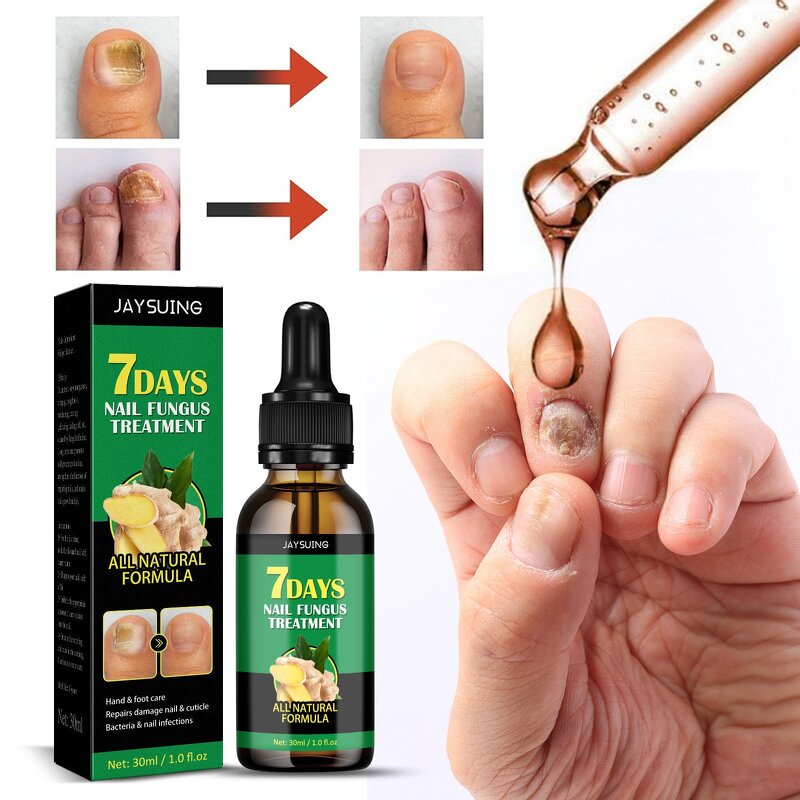 Nail Removal Gel Manufacturer - Jaysuing 7DAYS Repair Nail Treatments Essence Foot Care Toe Nails Fungal Anti-Infection