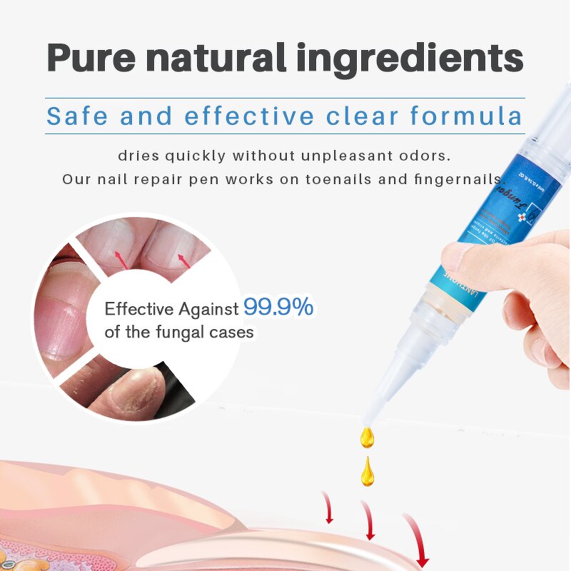 Nail Repair Pen Manufacturer - Lanthome Wholesale 4ml Herbal Anti Fungal Toenail Treatment Pen for Care