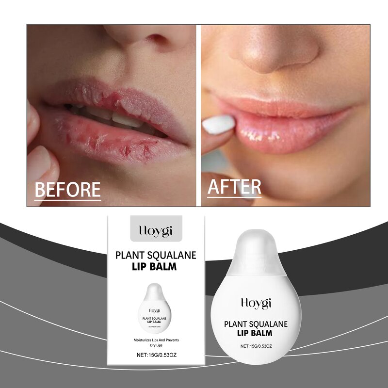 Beeswax Balm Manufacturer - HOYGI Organic Moisturizer Tallow Lip Treatment Most Popular