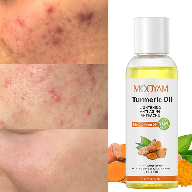 Turmeric Essential Oil Manufacturer - Acne Treatment Organic Skin Care Facial Serum Whitening Face Oils Pure Natural