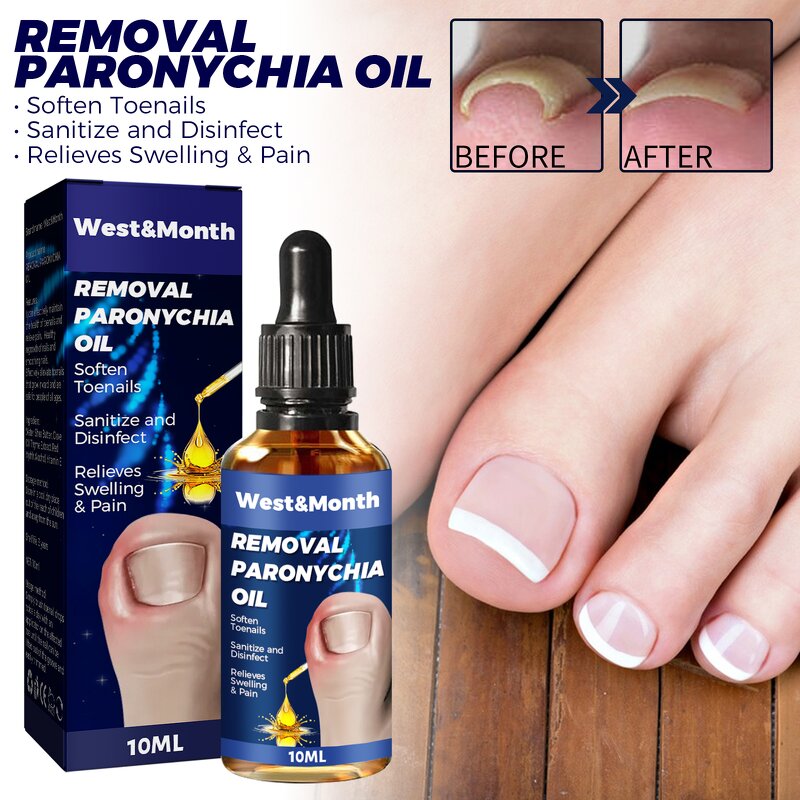 Nail Relief Oil Manufacturer - Wholesale WEST MONTH Nail Care Fast Effective Removal Anti Paronychia Relief 10ml