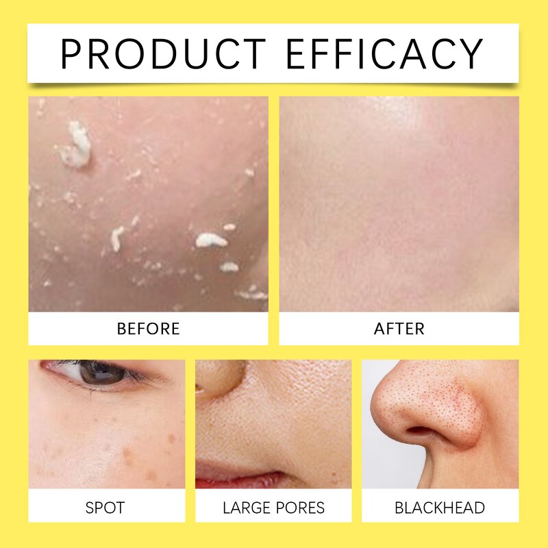 Cleaning Pads Manufacturer - OEM 55Pcs Turmeric Cleaning Exfoliating Remove Dark Spots Pimples Natural Organic Kojic Acid