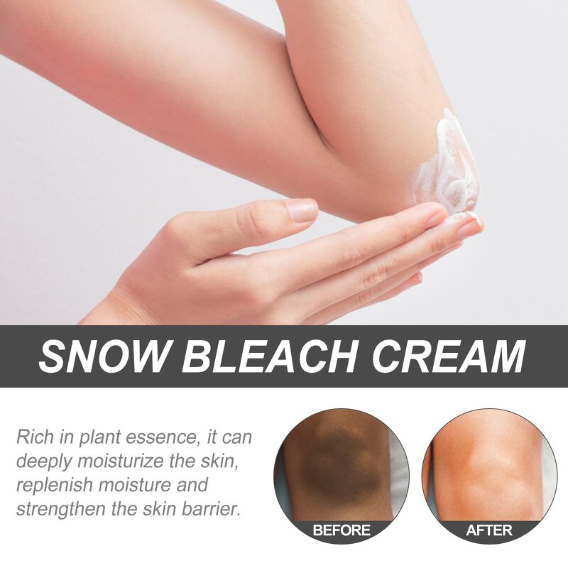 Dark Spots Cream Manufacturer - Women Dark Spots Eraser Lighten Armpit Thigh Knee Joint Radiance Whitening