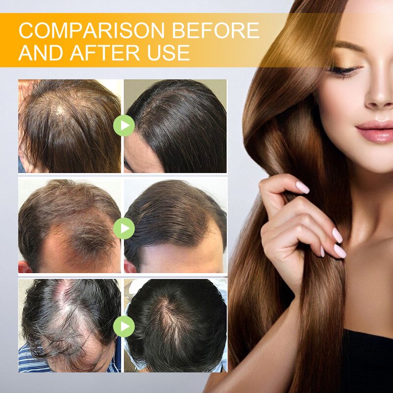 Hair Growth Serum Manufacturer - EELHOE Anti Hair Loss Treatment Ginger Oil Regrowth Care Biotin Men Women