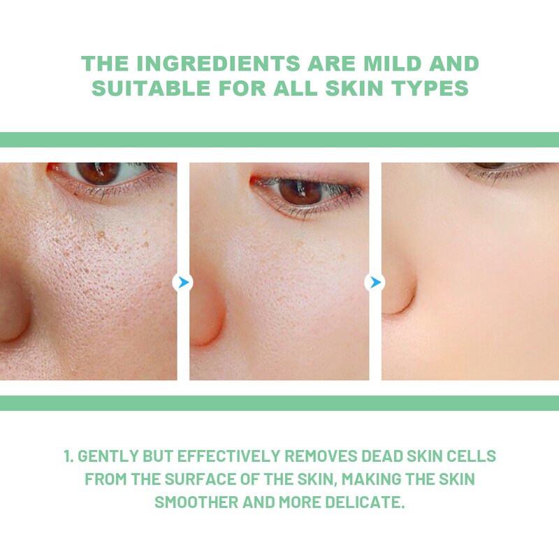 Exfoliating Gel Manufacturer - Hoygi Herbal Exfoliating Gently Clean Closed Mouth Shrink Pores Brightening