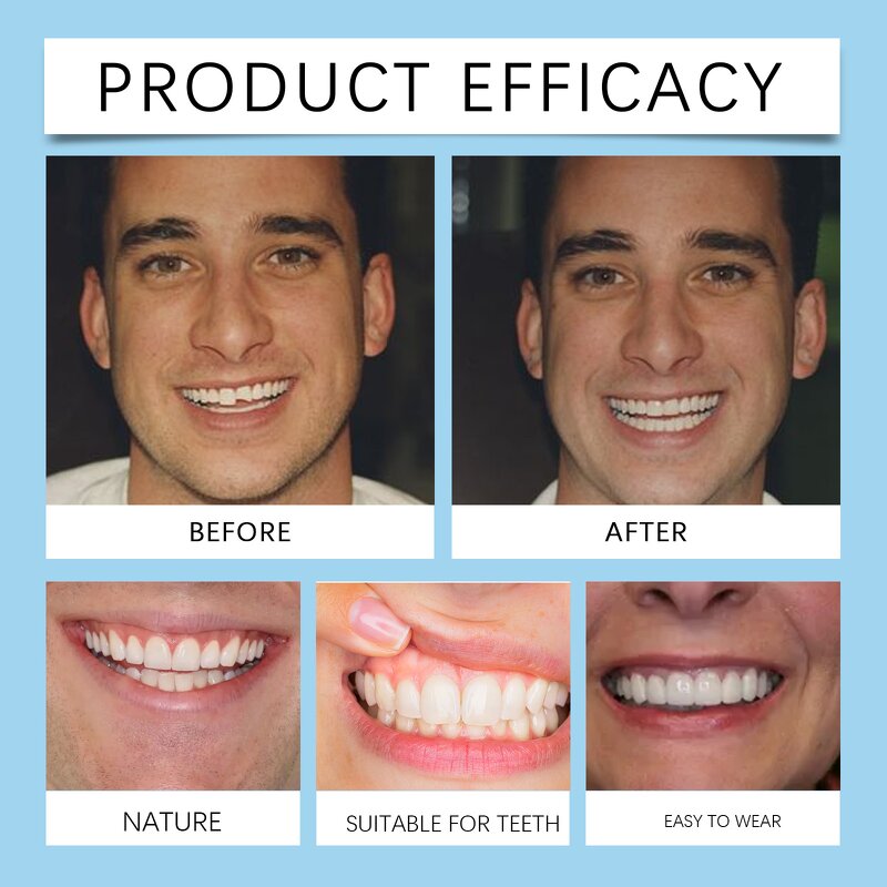 Dental Kit Manufacturer - Hot Sale Oralhoe Silicone Dentures Braces Retouching Filling Cosmetic Dental Kit False Teeth