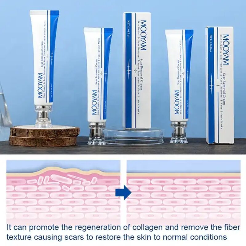 Scar Removal Cream Manufacturer - Fastest Acne Scar Face Care Scar Gel Bruise Repair Tummy Tuck 30g Stretch Mark