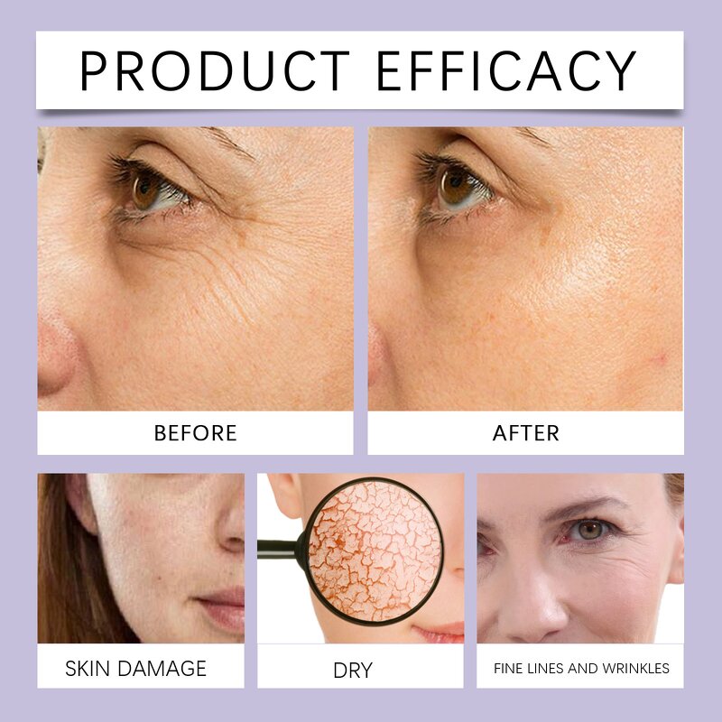 Anti-wrinkle Cream Manufacturer - Anti-wrinkle Skin Tightening Anti Aging Face Moisture Day Firming