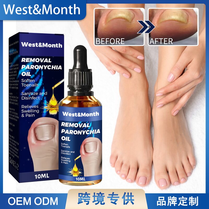 Nail Relief Oil Manufacturer - Wholesale WEST MONTH Nail Care Fast Effective Removal Anti Paronychia Relief 10ml