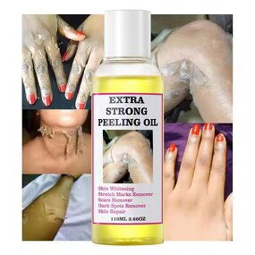 Peeling Oil Manufacturer - Private Label Extra Strong Peeling Oil Scar Remove Stretch Marks Whitening Yellow