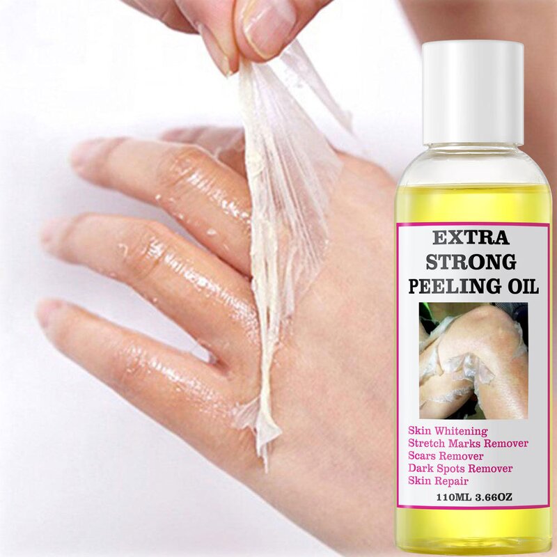 Peeling Oil Manufacturer - Wholesale Powerful Yellow Knuckle Skin Whitening Moisturizing Remove Dead Skin Exfoliating