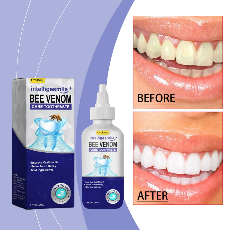 Whitening Toothpaste Manufacturer - ORALHOE Bee Venom Care Propolis Clean Tooth Stains Oral Odor Teeth Gum Care