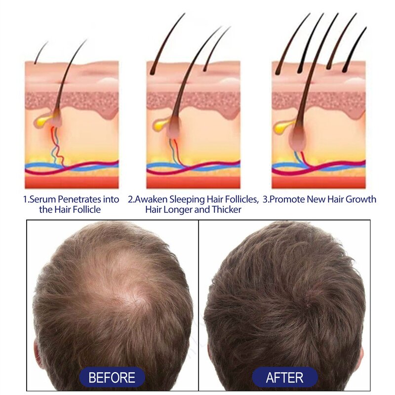 Hair Growth Foam Manufacturer - East Moon Men Deep Repair Hair Root Follicle Promotes Fast Growing Castor Argan Oil