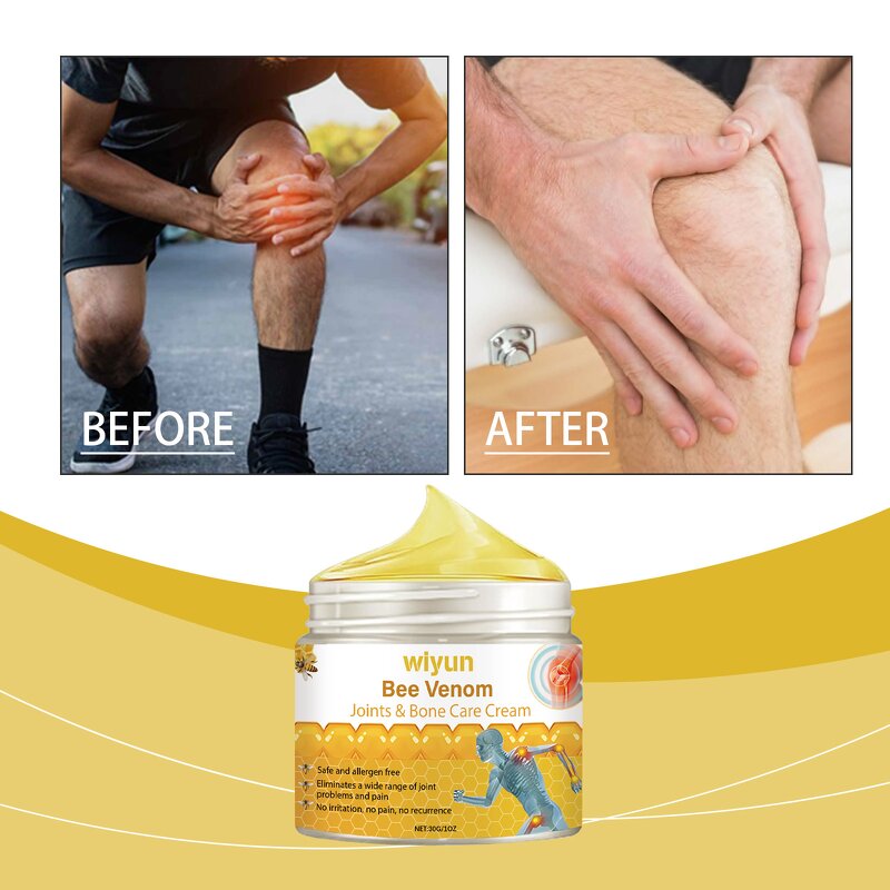 Joint Cream Manufacturer - Wholesale Natural Effective Bee Venom Joint Bone Knee Pain