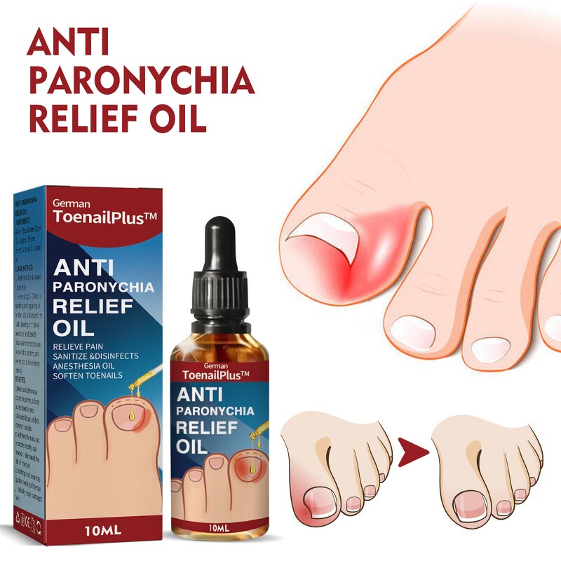 Nail Repair Liquid Manufacturer - Wholesale Fungal Nail Renewal Extra Strength Toe Fingernails Repair Damaged Broken