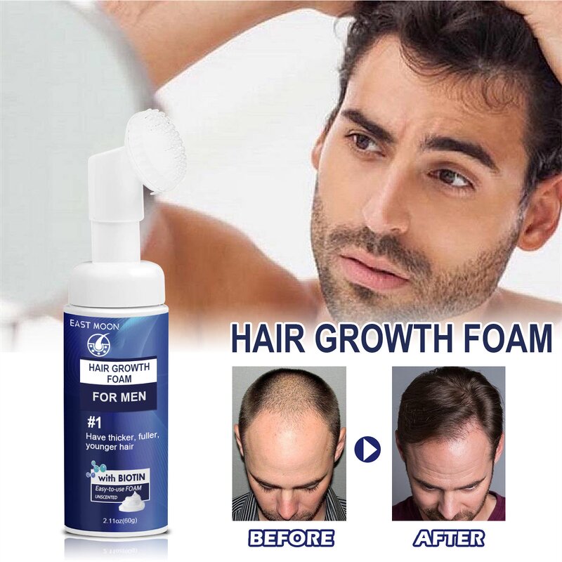 Hair Growth Foam Manufacturer - East Moon Men Deep Repair Hair Root Follicle Promotes Fast Growing Castor Argan Oil