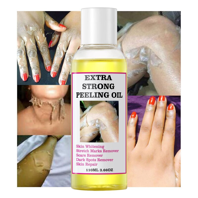 Peeling Oil Manufacturer - Wholesale Powerful Yellow Knuckle Skin Whitening Moisturizing Remove Dead Skin Exfoliating