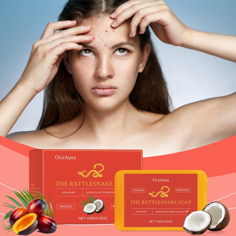 Facial Soap Manufacturer - 100% Organic Natural Plant Cleansing Control Oil Acne Nourish Skin Top Seller