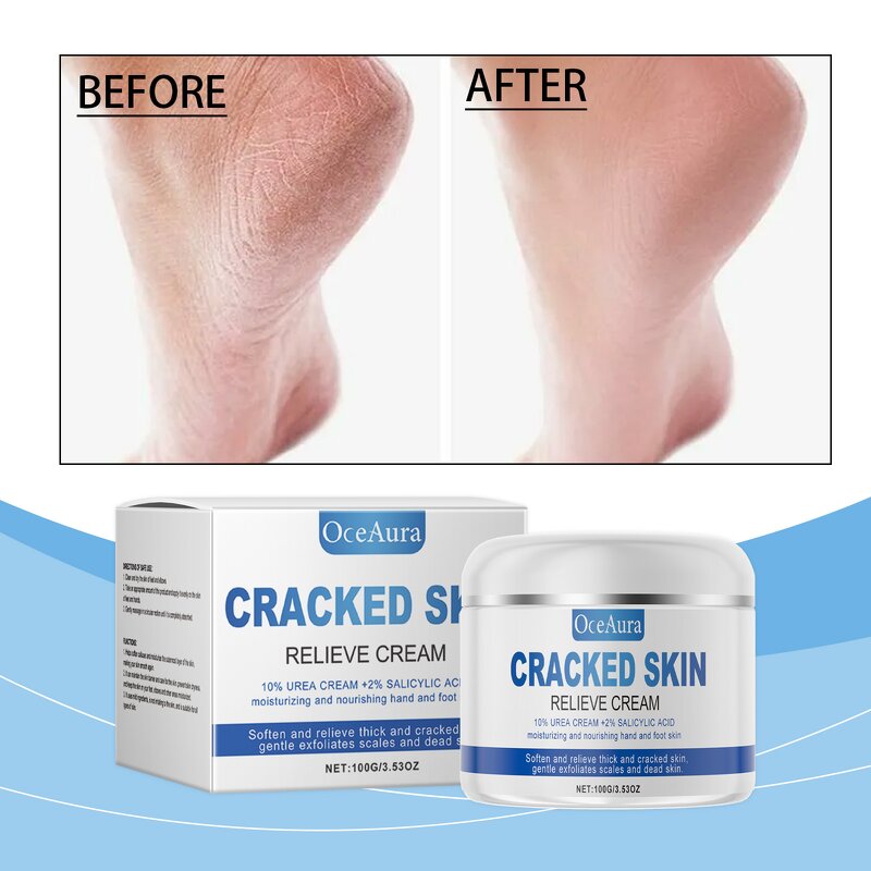 Skin Relieve Cream Manufacturer - OCEAURA Cracked Skin Relieve Foot Elbow Care Cosmetic Brand New