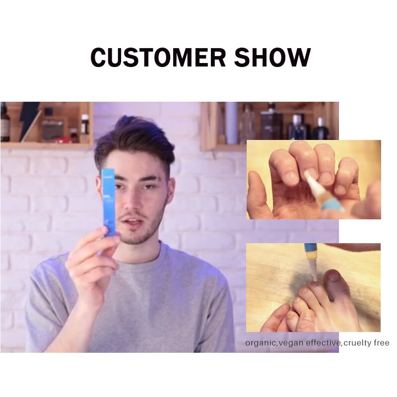 Nail Repair Pen Manufacturer - Lanthome Wholesale 4ml Herbal Anti Fungal Toenail Treatment Pen for Care