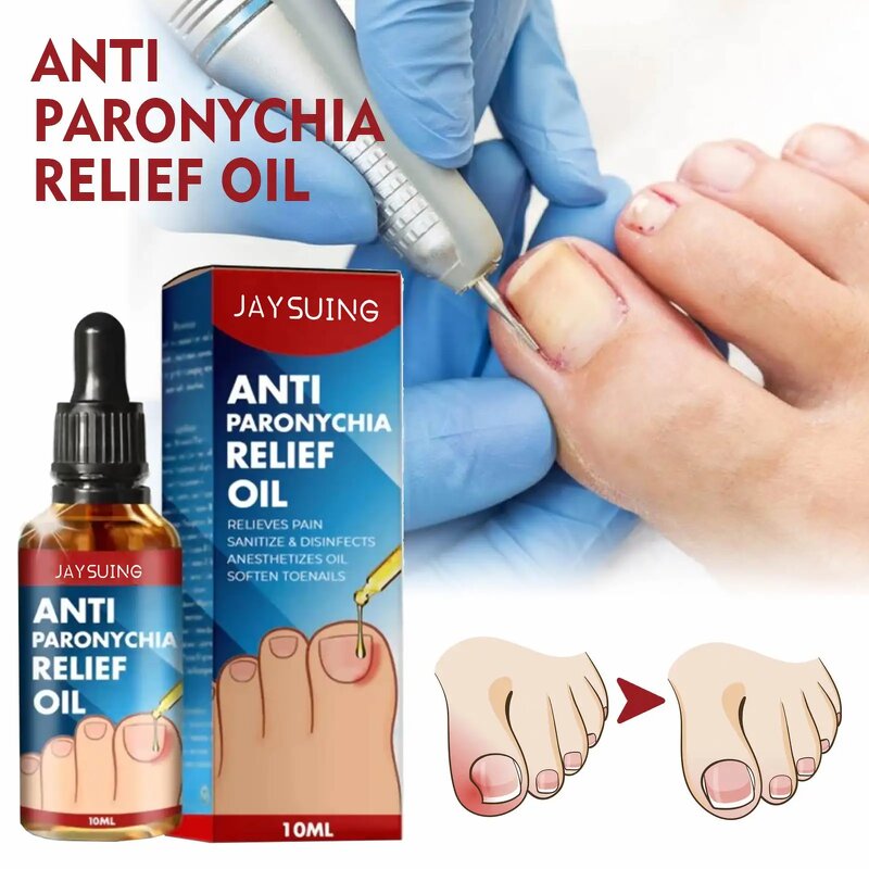 Nail Care Ointment Manufacturer - JAYSUING Nail Removal Oil Onychomycosis Treatment Paronychia Anti Infection Feet Toe