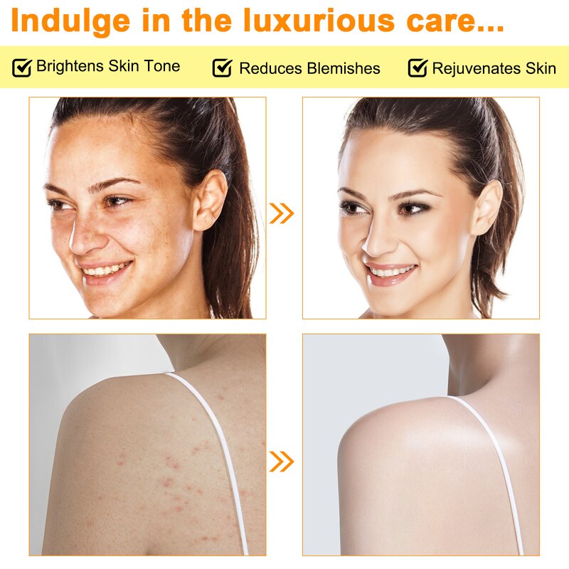 Kojic Acid Soap Manufacturer - Lemon Brightening 100% Natural Organic Cleaning Moisturizing Turmeric and Kojic Acid