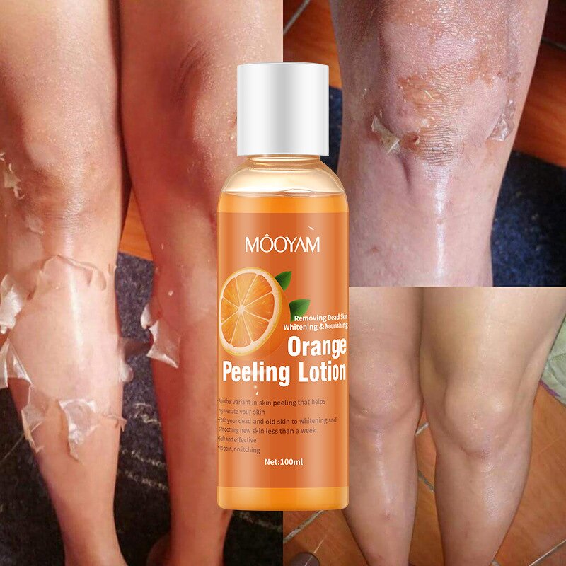 Exfoliating Gel Manufacturer - Extra Strong Peeling Oil Orange Peel Lotion Body Lotion
