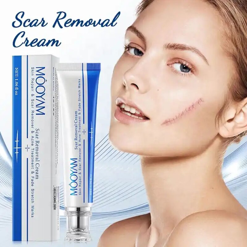 Scar Removal Cream Manufacturer - Fastest Acne Scar Face Care Scar Gel Bruise Repair Tummy Tuck 30g Stretch Mark