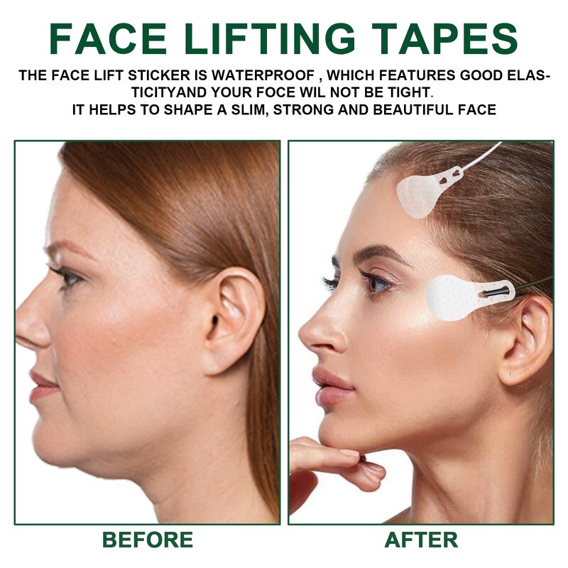 Face Lift Tape Manufacturer - West&Month Perthosite Lift Tighten Chin Shape V-face Slimming