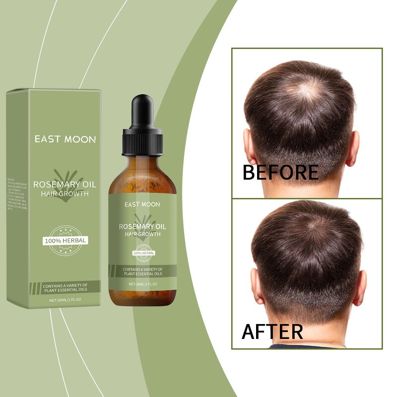 Rosemary Hair Essence Manufacturer - Dense Hair Prevents Mediterranean Alopecia Baldness Growth