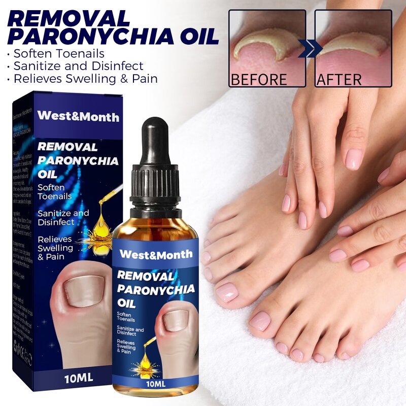 Nail Relief Oil Manufacturer - Wholesale WEST MONTH Nail Care Fast Effective Removal Anti Paronychia Relief 10ml