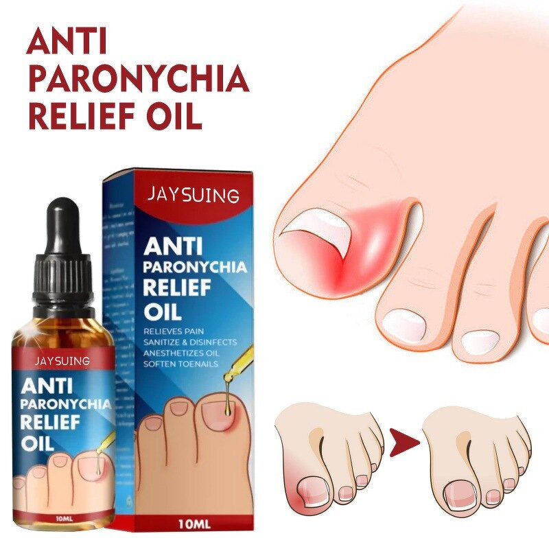 Nail Relief Oil Manufacturer - Wholesale High Quality Nail Removal Essence Toenail Treatment Anti Paronychia Relief