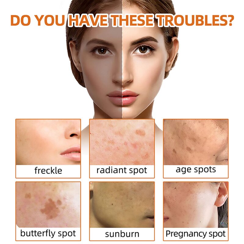 Turmeric Soap Manufacturer - New Arrival Natural Organic Face Cleansing Body Face Hand OEM Reduce Acne Handmade