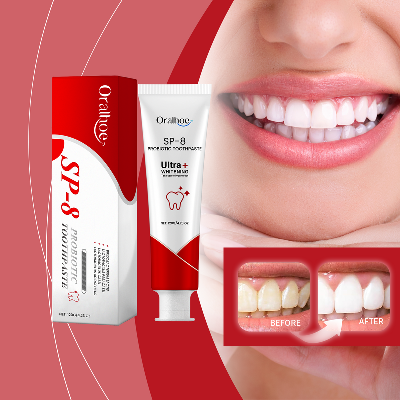 Whitening Toothpaste Manufacturer - New Product Sp-8 Probiotic Brightening Mint Fresh Breath Clean Beautiful Dental