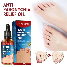 Nail Care Ointment Manufacturer - JAYSUING Nail Removal Oil Onychomycosis Treatment Paronychia Anti Infection Feet Toe