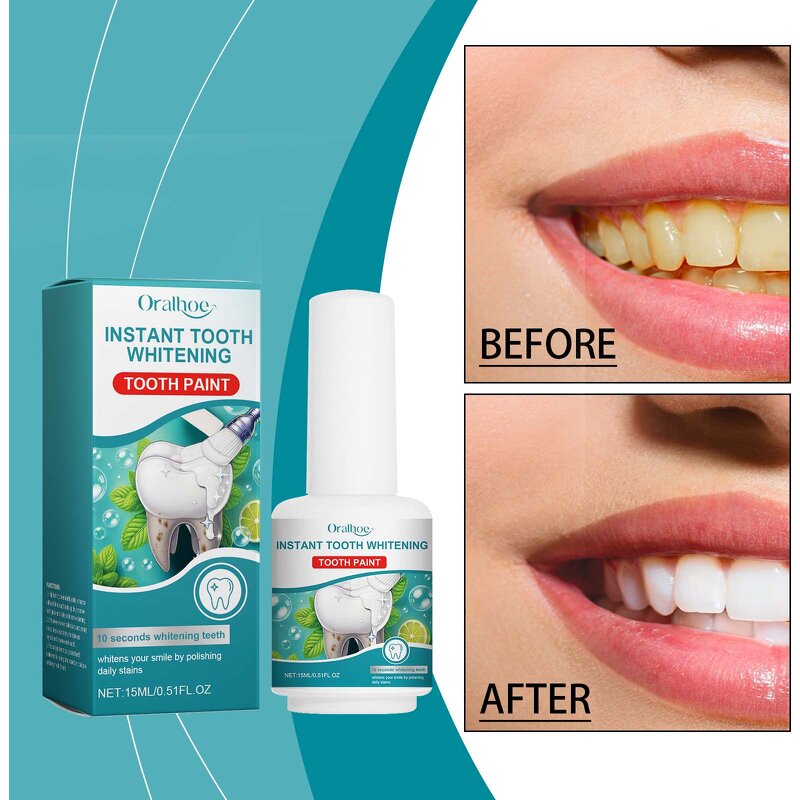 Tooth Whitening Solution Manufacturer - Hot Sale Clean Teeth Stains Oral Hygien Anti-pigmentation Natural Instant