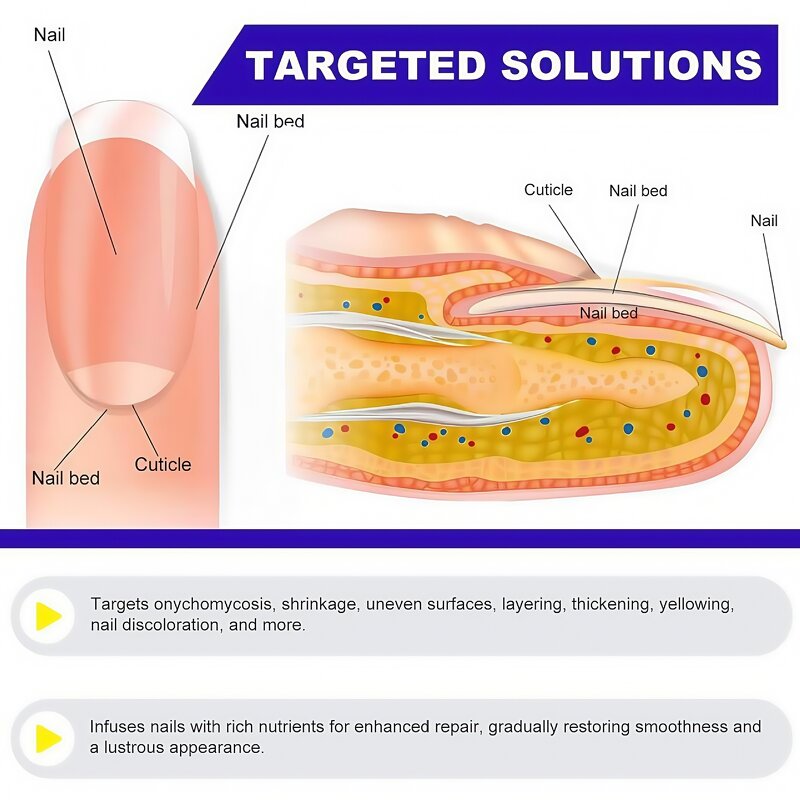 Nail Patches Manufacturer - Best Anti Fungal Nail Treatment Stickers Private Label OEM 8 Hours Overnight Repair