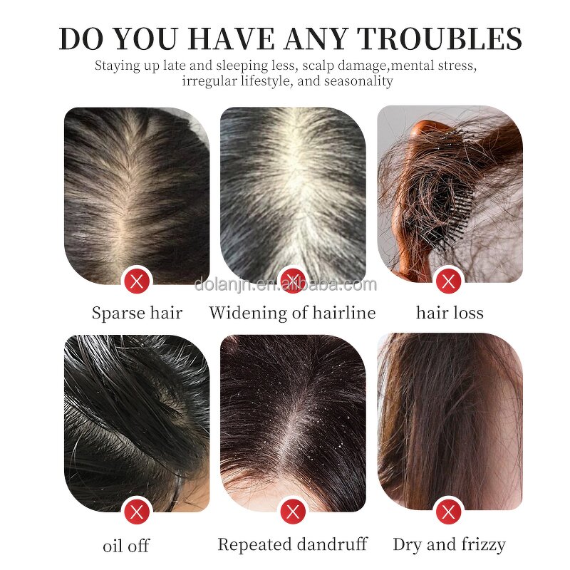 Hair Shampoo Manufacturer - Turmeric Herbal Extract Organic Nourishing Anti-hair Loss