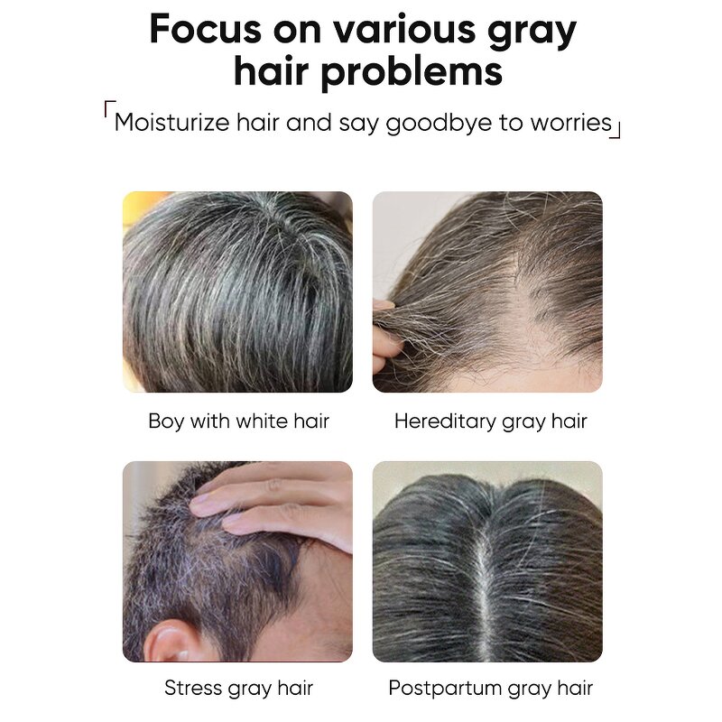 Hair Treatment Serum Manufacturer - Gray White White to Black Natural Color Repair Nourish Black Hair
