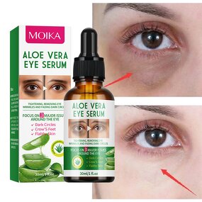 Eye Serum Manufacturer - Wholesale Organic Removal Fine Line Dark Circle Lifting Firming Aloe Vera