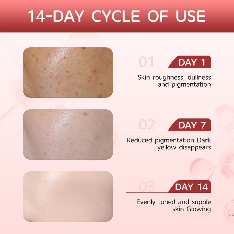 Whitening Serum Manufacturer - 10% Niacinamide 4% Tranexamic Acid Dark Spots Correcting Sensitive Skin