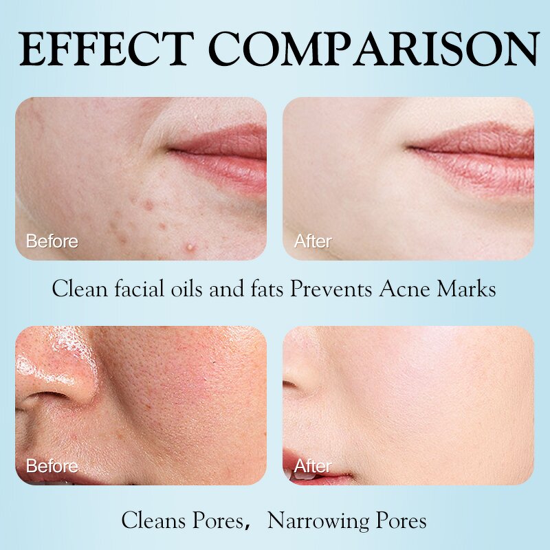 Face Wash Manufacturer - Hydrating Cleansing Mousse Pore Oil Makeup Removing Vitamin C Private Label