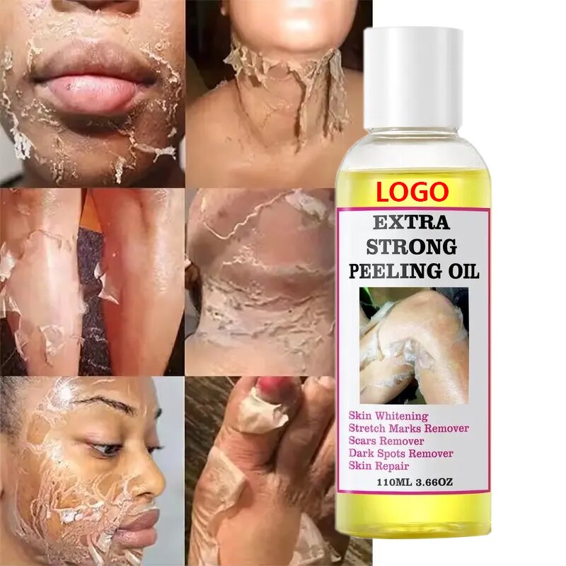 Peeling Oil Manufacturer - OEM Body Skin Care Yellow Dark Spots Removers Strong Knuckle Whitening