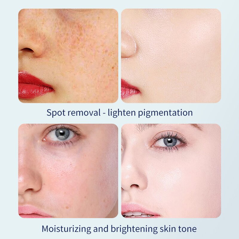 Whitening Cream Manufacturer - 377 Freckle Removal Anti Aging Brightening Private Label 377vc Serum