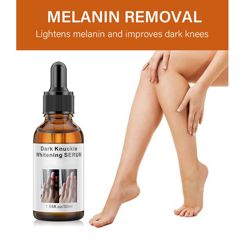 Dark Knuckles Whitening Serum Manufacturer - Fast Whitening Hand Knuckle Elbows Knee Stains Remover OEM Private Label
