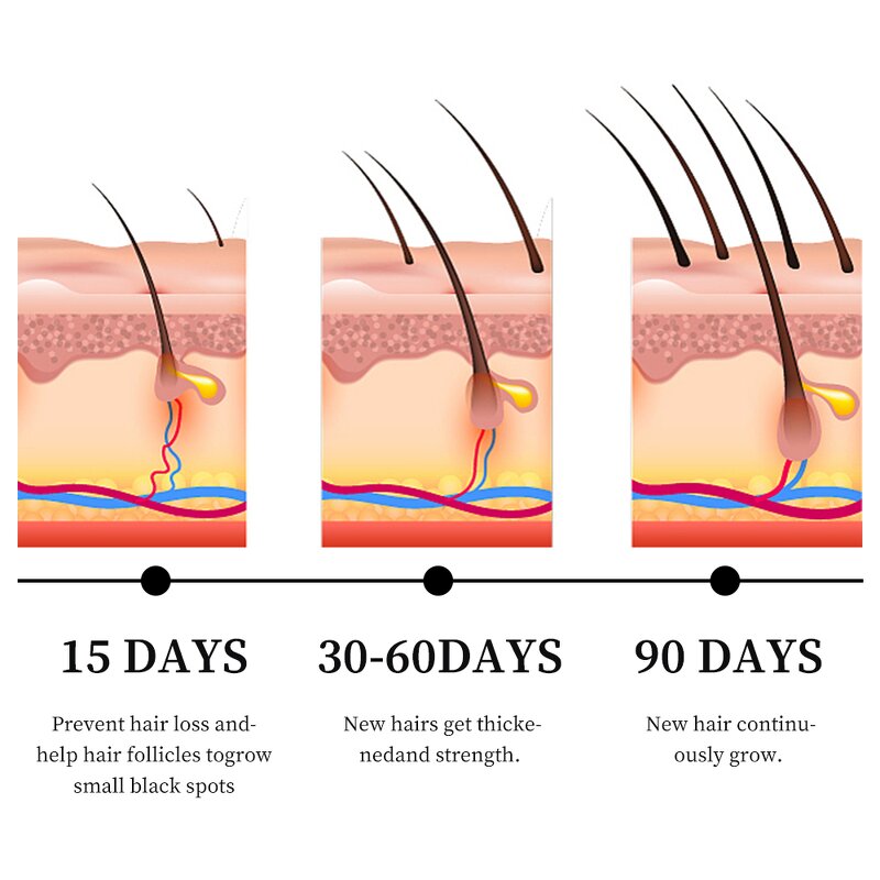 Hair Growth Serum Manufacturer - Anti Hair Loss Ginger Oil Regrowth Care Vitamin B5 Biotin Men Women