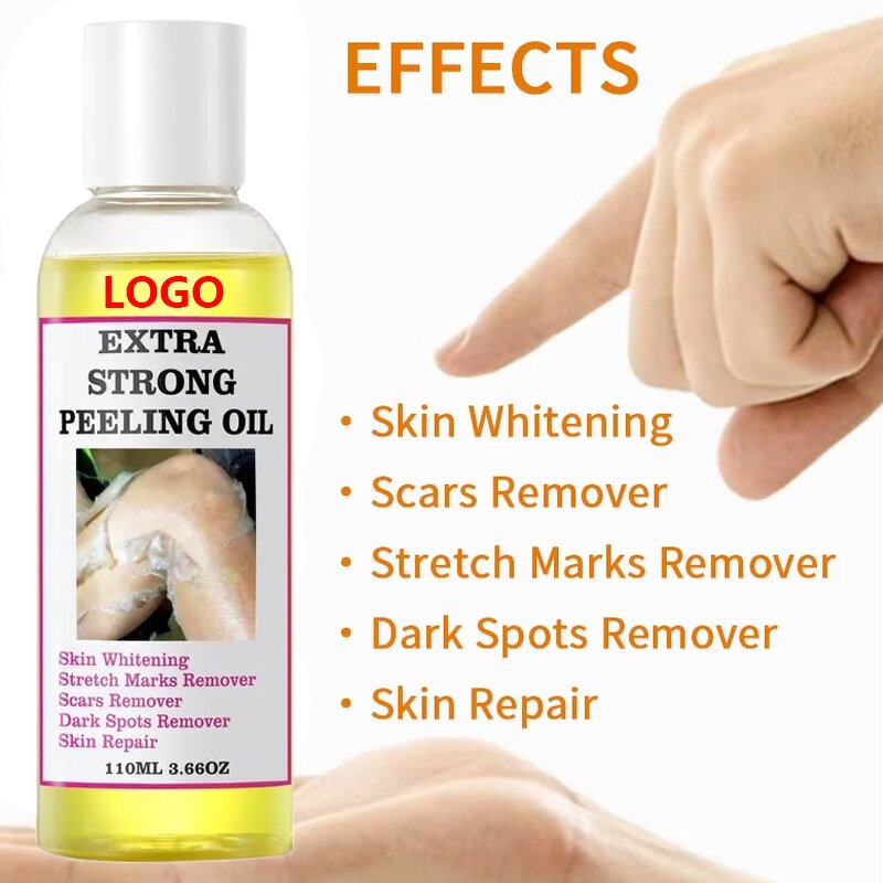 Peeling Oil Manufacturer - OEM Body Skin Care Yellow Dark Spots Removers Strong Knuckle Whitening