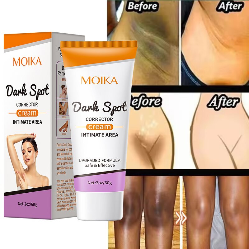 Skin Lightening Cream Manufacturer - Private Label Dark Spots Eraser Underarm Bikini Inner Thigh Private Label