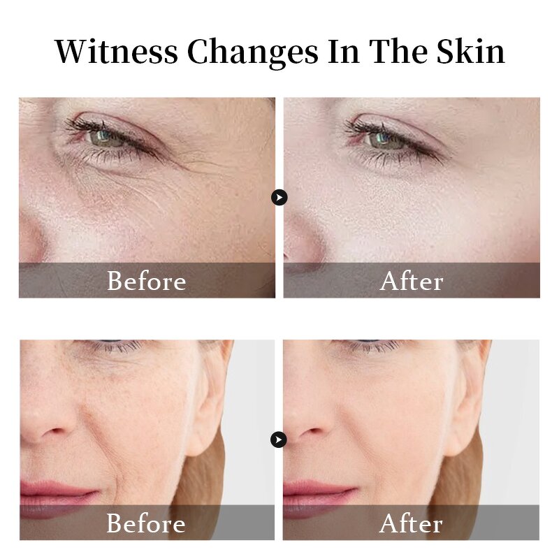 Vitamin C Serum Manufacturer - 5 in 1 Whitening Anti Age 30% Vitamin C 5% Niacinamide 10% Vitamin E